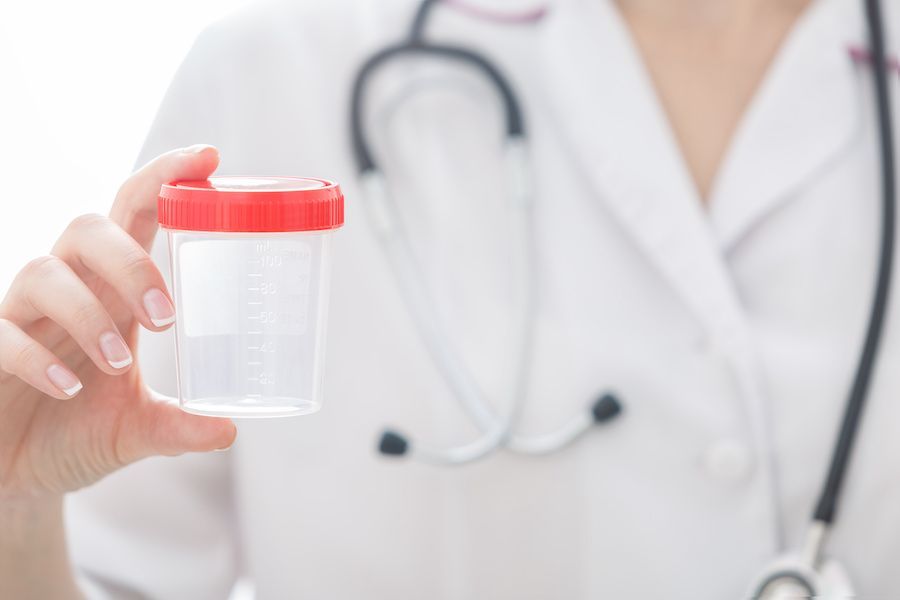 Test Antidroga Lavoratori